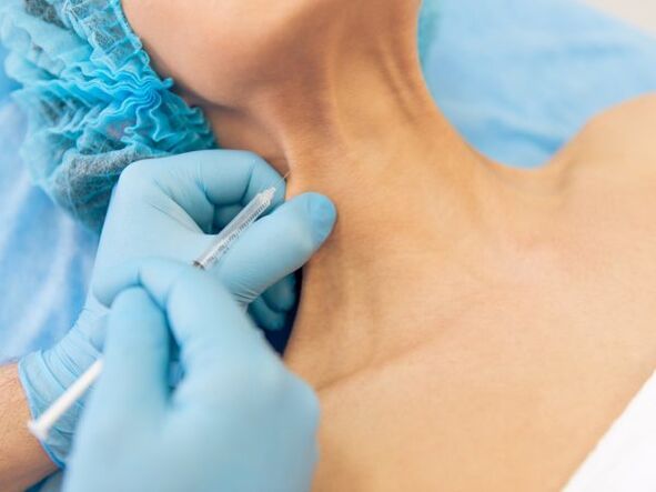 المزايا
